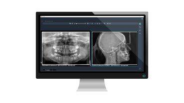 Acteon X-MIND® PRIME 3D Röntgengerät