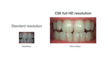 Acteon C50 Full HD Intraoralkamera