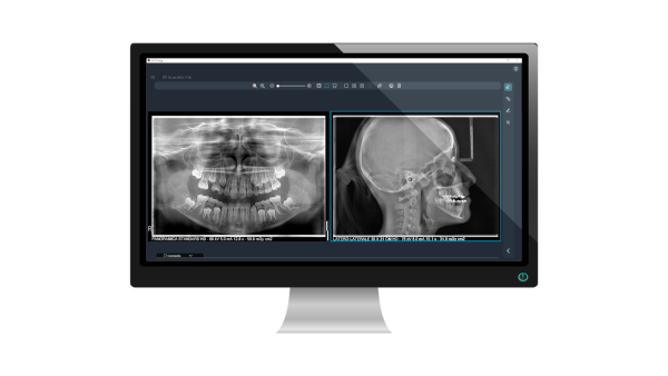 Acteon X-MIND® PRIME 3D Röntgengerät