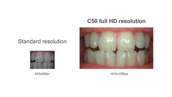 Acteon C50 Full HD Intraoralkamera